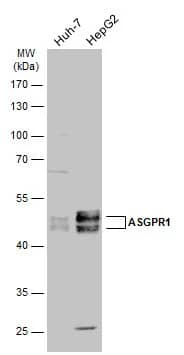 Western Blot: ASGPR1 Antibody [NBP2-15489] - Various whole cell extracts (30 ug) were separated by 10% SDS-PAGE, and the membrane was blotted with ASGPR1 antibody [N1C3] (NBP2-15489) diluted at 1:3000. The HRP-conjugated anti-rabbit IgG antibody  was used to detect the primary antibody.