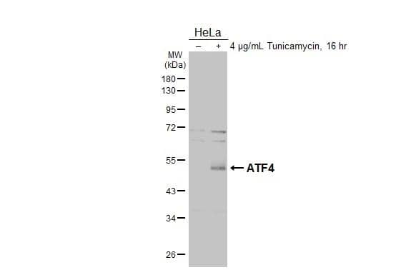 <b>Biological Strategies Validation. </b>Untreated (-) and treated (+) HeLa whole cell extracts (30 ug) were separated by 10% SDS-PAGE, and the membrane was blotted with ATF4 antibody (NBP2-15499) diluted at 1:1000. The HRP-conjugated anti-rabbit IgG antibody  was used to detect the primary antibody. 