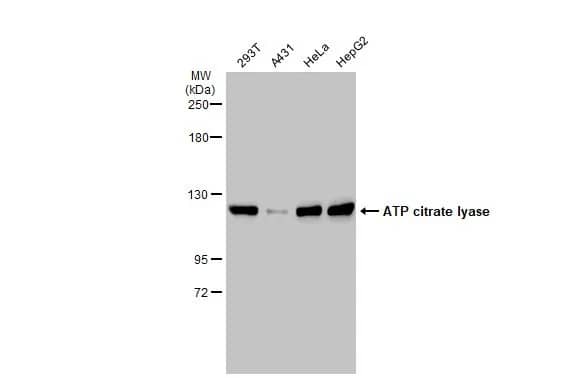 Western Blot: ATP Citrate Lyase Antibody [NBP2-15510] - Various whole cell extracts (30 ug) were separated by 5% SDS-PAGE, and the membrane was blotted with ATP Citrate Lyase antibody [N1N2], N-term (NBP2-15510) diluted at 1:5000. The HRP-conjugated anti-rabbit IgG antibody  was used to detect the primary antibody.