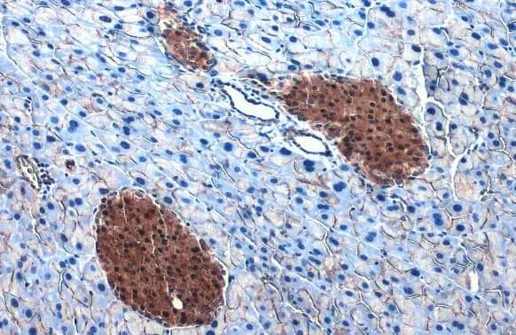 Immunohistochemistry-Paraffin: ATP Citrate Lyase Antibody [NBP2-15510] - ATP Citrate Lyase antibody [N1N2], N-term detects ATP Citrate Lyase protein at cytoplasm by immunohistochemical analysis.Sample: Paraffin-embedded mouse pancreas.ATP Citrate Lyase stained by ATP Citrate Lyase antibody [N1N2], N-term (NBP2-15510) diluted at 1:500.Antigen Retrieval: Citrate buffer, pH 6.0, 15 min