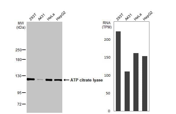 Various whole cell extracts (30 ug) were separated by 5% SDS-PAGE, and the membrane was blotted with ATP citrate lyase antibody [N1N2], N-term (NBP2-15510) diluted at 1:5000. The HRP-conjugated anti-rabbit IgG antibody  was used to detect the primary antibody. Corresponding RNA expression data for the same cell lines are based on Human Protein Atlas program. 