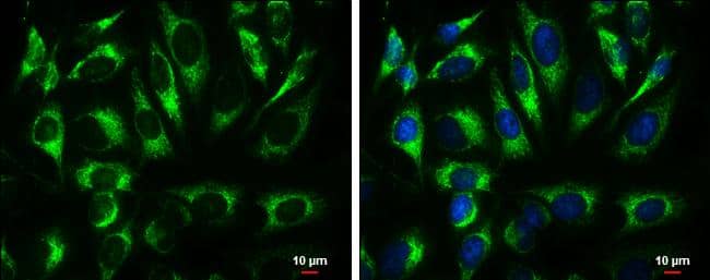 ATP5A1 antibody [C2C3], C-term detects ATP5A1 protein at mitochondria by immunofluorescent analysis.Sample: HeLa cells were fixed in 4% paraformaldehyde at RT for 15 min.Green: ATP5A1 protein stained by ATP5A1 antibody [C2C3], C-term (NBP2-15512) diluted at 1:500.Blue: Hoechst 33342 staining.Scale bar = 10 um. 