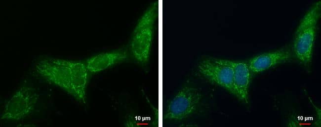 ATP synthase B1 antibody [N1C3] detects ATP synthase B1 protein at mitochondria by immunofluorescent analysis.Sample: SKNSH cells were fixed in 2% paraformaldehyde/culture medium at 37C for 30 min.Green: ATP synthase B1 protein stained by ATP synthase B1 antibody [N1C3] (NBP2-15513) diluted at 1:500.Blue: Hoechst 33342 staining. 
