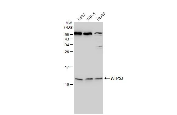 Western Blot: ATP5J Antibody [NBP2-15514] - Various whole cell extracts (30 ug) were separated by 15% SDS-PAGE, and the membrane was blotted with ATP5J antibody (NBP2-15514) diluted at 1:1000. The HRP-conjugated anti-rabbit IgG antibody  was used to detect the primary antibody.