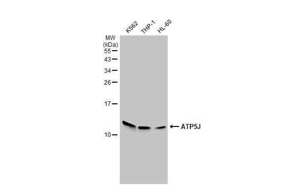 Various whole cell extracts (30 ug) were separated by 15% SDS-PAGE, and the membrane was blotted with ATP5J antibody (NBP2-15514) diluted at 1:1000. The HRP-conjugated anti-rabbit IgG antibody  was used to detect the primary antibody. 