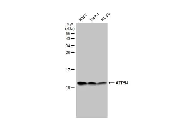 Various whole cell extracts (30 ug) were separated by 15% SDS-PAGE, and the membrane was blotted with ATP5J antibody (NBP2-15514) diluted at 1:1000. The HRP-conjugated anti-rabbit IgG antibody  was used to detect the primary antibody. 