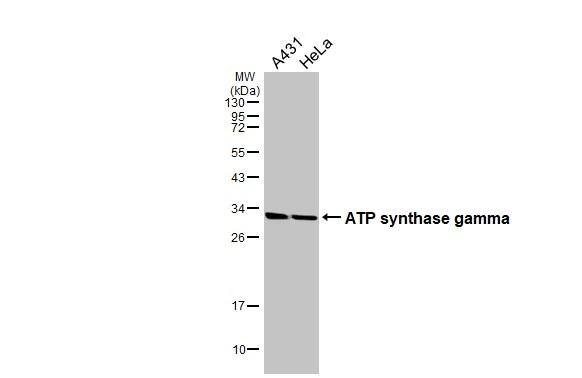 Various whole cell extracts (30 ug) were separated by 12% SDS-PAGE, and the membranes were blotted with ATP synthase gamma antibody (NBP2-15525) diluted at 1:1000. The HRP-conjugated anti-rabbit IgG antibody  was used to detect the primary antibody 