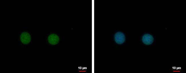 C17orf49 antibody detects C17orf49 protein at nucleus by immunofluorescent analysis.Sample: MCF-7 cells were fixed in 4% paraformaldehyde at RT for 15 min.Green: C17orf49 protein stained by C17orf49 antibody (NBP2-15546) diluted at 1:500.Blue: Hoechst 33342 staining.Scale bar = 10 um. 