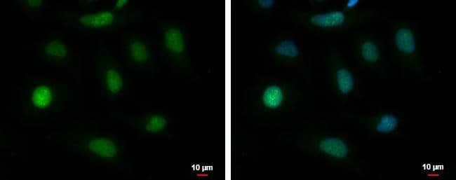 BAT3 antibody [N1N2], N-term detects BAT3 protein at nucleus by immunofluorescent analysis.Sample: HeLa cells were fixed in 4% paraformaldehyde at RT for 15 min.Green: BAT3 protein stained by BAT3 antibody [N1N2], N-term (NBP2-15547) diluted at 1:500.Blue: Hoechst 33342 staining.Scale bar = 10 um. 