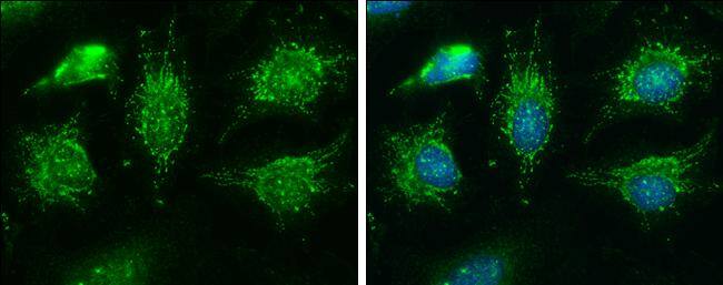 BCKDHA antibody [C1C3] detects BCKDHA protein at mitochondria by immunofluorescent analysis.Sample: HeLa cells were fixed in ice-cold MeOH for 5 min.Green: BCKDHA protein stained by BCKDHA antibody [C1C3] (NBP2-15552) diluted at 1:400.Blue: Hoechst 33342 staining. 