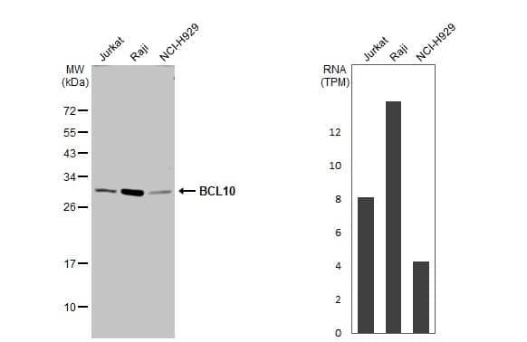 Various whole cell extracts (30 ug) were separated by 12% SDS-PAGE, and the membrane was blotted with BCL10 antibody (NBP2-15554) diluted at 1:1000. The HRP-conjugated anti-rabbit IgG antibody  was used to detect the primary antibody. Corresponding RNA expression data for the same cell lines are based on Human Protein Atlas program. 