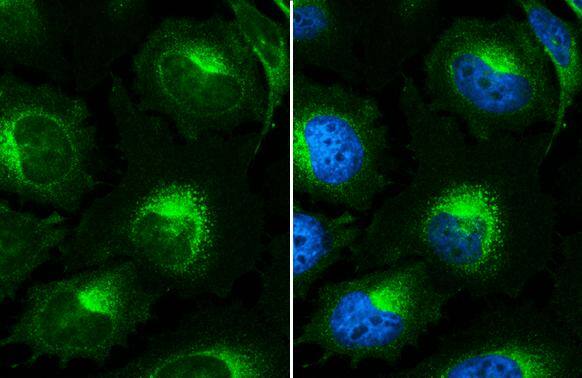 beta 2 Microglobulin antibody detects beta 2 Microglobulin protein by immunofluorescent analysis.Sample: HeLa cells were fixed in 4% paraformaldehyde at RT for 15 min.Green: beta 2 Microglobulin stained by beta 2 Microglobulin antibody (NBP2-15566) diluted at 1:500.Blue: Fluoroshield with DAPI . 