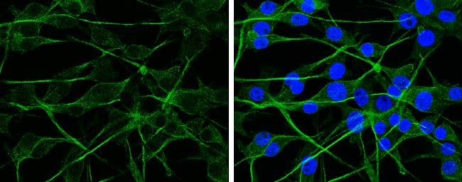 APP antibody detects APP protein at cytoplasm by immunofluorescent analysis.Sample: U-87 MG cells were fixed in 4% paraformaldehyde at RT for 15 min.Green: APP protein stained by APP antibody (NBP2-15575) diluted at 1:100.Blue: Hoechst 33342 staining. 