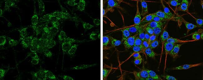 APP antibody detects APP protein at cytoplasm by immunofluorescent analysis.Sample: SH-SY5Y cells were fixed in 4% paraformaldehyde at RT for 15 min.Green: APP protein stained by APP antibody (NBP2-15575) diluted at 1:100.Red: beta Tubulin 3/ TUJ1 protein stained by beta Tubulin 3/ TUJ1 antibody  diluted at 1:200.Blue: Hoechst 33342 staining. 
