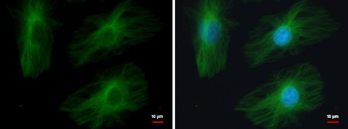 Immunocytochemistry/ Immunofluorescence beta II Tubulin A Antibody