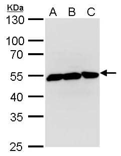 Western Blot beta II Tubulin A Antibody