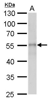 beta Tubulin 2 antibody detects beta Tubulin 2 protein by Western blot analysis.A. 30 ug drosophila lysate/extract10 % SDS-PAGEbeta Tubulin 2 antibody (NBP2-15581) dilution: 1:2000 