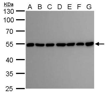 Western Blot beta II Tubulin A Antibody