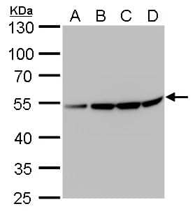 beta Tubulin 2 antibody detects beta Tubulin 2 protein by Western blot analysis.A. 30 ug U87-MG whole cell lysate/extractB. 30 ug SK-N-SH whole cell lysate/extract  C. 30 ug IMR32 whole cell lysate/extract  D. 30 ug SK-N-AS whole cell lysate/extract10 % SDS-PAGEbeta Tubulin 2 antibody (NBP2-15581) dilution: 1:10000 