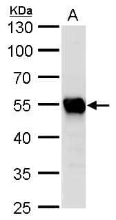 beta Tubulin 2 antibody detects beta Tubulin 2 protein by Western blot analysis.A. 50 ug rat brain lysate/extract10 % SDS-PAGEbeta Tubulin 2 antibody (NBP2-15581) dilution: 1:5000 