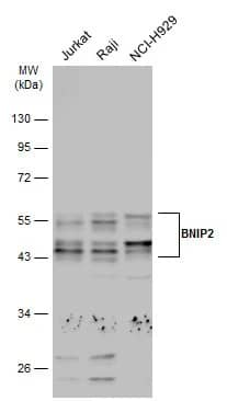 Western Blot: BNIP2 Antibody [NBP2-15602] - Various whole cell extracts (30 ug) were separated by 10% SDS-PAGE, and the membrane was blotted with BNIP2 antibody (NBP2-15602) diluted at 1:1000. The HRP-conjugated anti-rabbit IgG antibody  was used to detect the primary antibody.