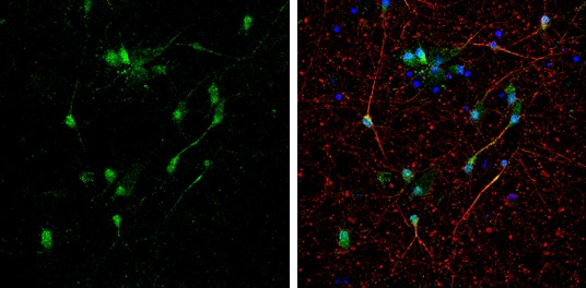 Immunocytochemistry/ Immunofluorescence: BNIP2 Antibody [NBP2-15602] - BNIP2 antibody detects BNIP2 protein by immunofluorescent analysis.Sample: DIV10 rat E18 primary cortical neurons were fixed in 4% paraformaldehyde at RT for 15 min.Green: BNIP2 protein stained by BNIP2 antibody (NBP2-15602) diluted at 1:500.Red: beta Tubulin 3/ Tuj1, stained by beta Tubulin 3/ Tuj1 antibody [GT1338]  diluted at 1:500.Blue: Fluoroshield with DAPI .