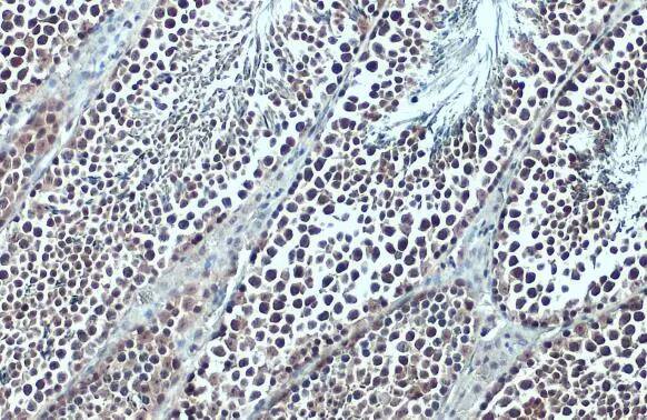 Immunohistochemistry-Paraffin: BRD3 Antibody [NBP2-15612] - BRD3 antibody detects BRD3 protein at nucleus by immunohistochemical analysis.Sample: Paraffin-embedded mouse testis.BRD3 stained by BRD3 antibody (NBP2-15612) diluted at 1:500.Antigen Retrieval: Citrate buffer, pH 6.0, 15 min