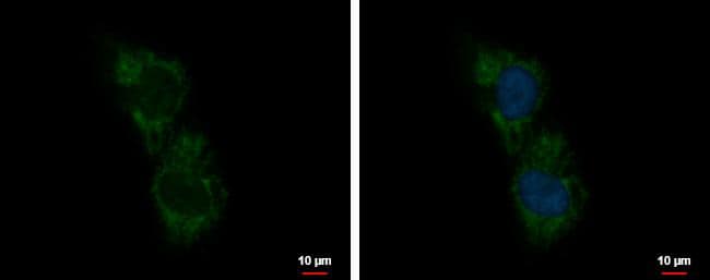 C5orf54 antibody detects C5orf54 protein at mitochondria by immunofluorescent analysis.Sample: H1299 cells were fixed in 4% paraformaldehyde at RT for 15 min.Green: C5orf54 protein stained by C5orf54 antibody (NBP2-15630) diluted at 1:500.Blue: Hoechst 33342 staining.Scale bar = 10 um. 