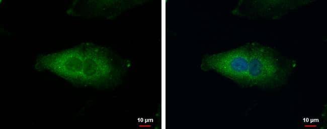 Immunocytochemistry/ Immunofluorescence NDUFAF5 Antibody - BSA Free