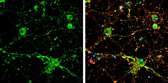 Immunocytochemistry/ Immunofluorescence: Calcineurin A Antibody [NBP2-15663] - Calcineurin A antibody detects Calcineurin A protein by immunofluorescent analysis.Sample: DIV9 rat E18 primary cortical neuron cells were fixed in 4% paraformaldehyde at RT for 15 min.Green: Calcineurin A stained by Calcineurin A antibody (NBP2-15663) diluted at 1:500.Red: beta Tubulin 3/ Tuj1, stained by beta Tubulin 3/ Tuj1 antibody [GT1338]  diluted at 1:500.Blue: Fluoroshield with DAPI .