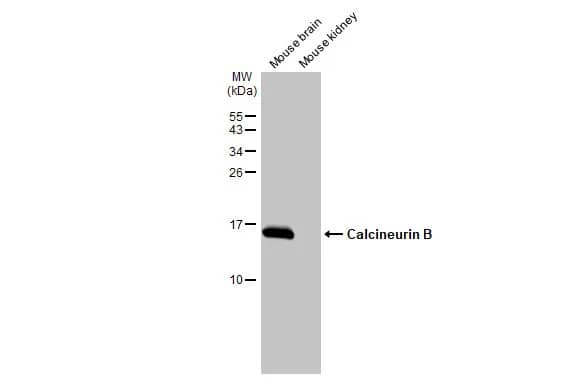 Western Blot: Calcineurin B Antibody [NBP2-15664] - Various tissue extracts (50 ug) were separated by 15% SDS-PAGE, and the membrane was blotted with Calcineurin B antibody (NBP2-15664) diluted at 1:1000. The HRP-conjugated anti-rabbit IgG antibody  was used to detect the primary antibody.