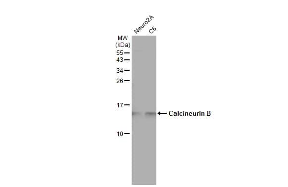 Western Blot: Calcineurin B Antibody [NBP2-15664] - Various whole cell extracts (30 ug) were separated by 15% SDS-PAGE, and the membrane was blotted with Calcineurin B antibody (NBP2-15664) diluted at 1:1000. The HRP-conjugated anti-rabbit IgG antibody  was used to detect the primary antibody, and the signal was developed with Trident ECL plus-Enhanced.