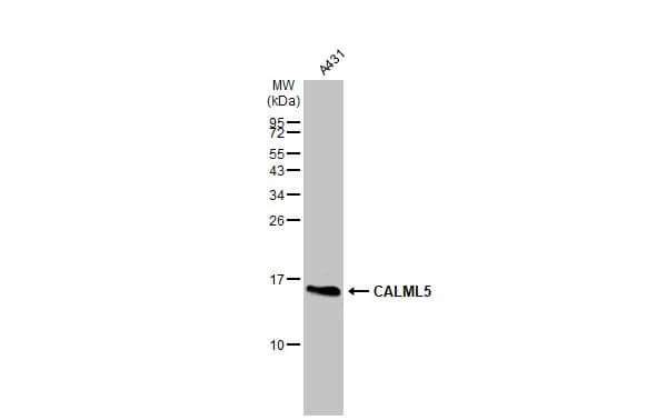 Western Blot: CALML5 Antibody [NBP2-15668] - Whole cell extract (30 ug) was separated by 15% SDS-PAGE, and the membrane was blotted with CALML5 antibody [N1C3] (NBP2-15668) diluted at 1:1000. The HRP-conjugated anti-rabbit IgG antibody  was used to detect the primary antibody.