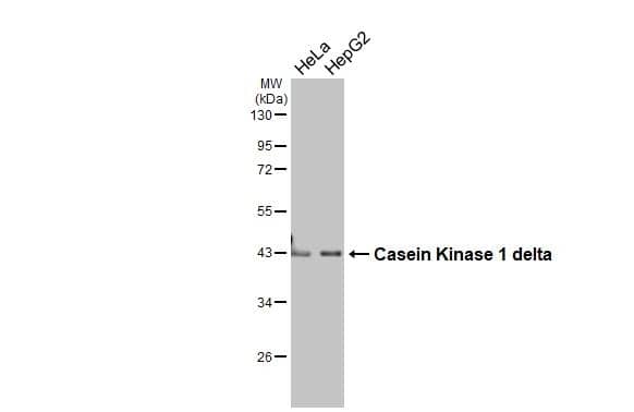 Various whole cell extracts (30 ug) were separated by 10% SDS-PAGE, and the membrane was blotted with Casein Kinase 1 delta antibody (NBP2-15708) diluted at 1:2000. The HRP-conjugated anti-rabbit IgG antibody  was used to detect the primary antibody. 
