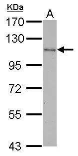 CBL antibody [C2C3], C-term detects CBL protein by Western blot analysis.A. 30 ug THP-1 whole cell lysate/extract7.5 % SDS-PAGECBL antibody [C2C3], C-term (NBP2-15730) dilution: 1:1000 