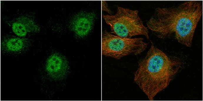 CCDC14 antibody [C2C3], C-term detects CCDC14 protein at cytoplasm and nucleus by immunofluorescent analysis.Sample: HeLa cells were fixed in 4% paraformaldehyde at RT for 15 min.Green: CCDC14 protein stained by CCDC14 antibody [C2C3], C-term (NBP2-15742) diluted at 1:1000.Red: alpha Tubulin, a cytoskeleton marker, stained by alpha Tubulin antibody [GT114]  diluted at 1:1000.Blue: Hoechst 33342 staining. 