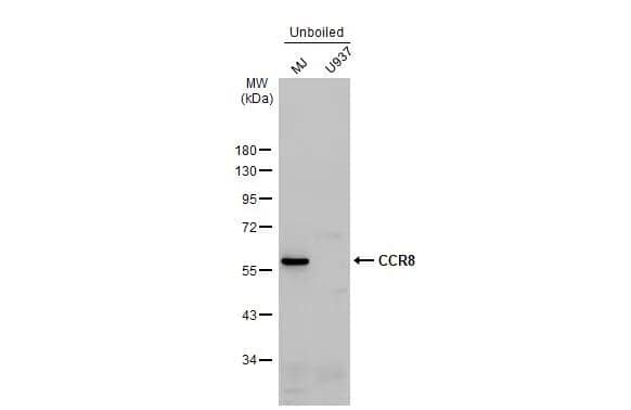 Various unboiled whole cell extracts (30 ug) were separated by 10% SDS-PAGE, and the membrane was blotted with CCR8 antibody (NBP2-15767) diluted at 1:1000. The HRP-conjugated anti-rabbit IgG antibody  was used to detect the primary antibody. 
