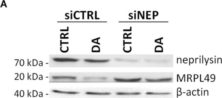 MRPL49 protein is a substrate of neprilysin. (A) Representative WB analysis showing the rescue of MRPL49 levels, after neprilysin knock-down (KD). siCTRL: pool of control siRNAs. siNEP: pool of neprilysin-silencing siRNAs. (B) Relative fold-change in the levels of neprilysin protein in both controls (siCTRL) and neprilysin-silenced (siNEP) cells upon DA treatment, showing the effectiveness of the KD. Three biological replicates (n=3). Error bars: SEM. Statistical analysis performed by two-way ANOVA, to assess the effects of both “KD