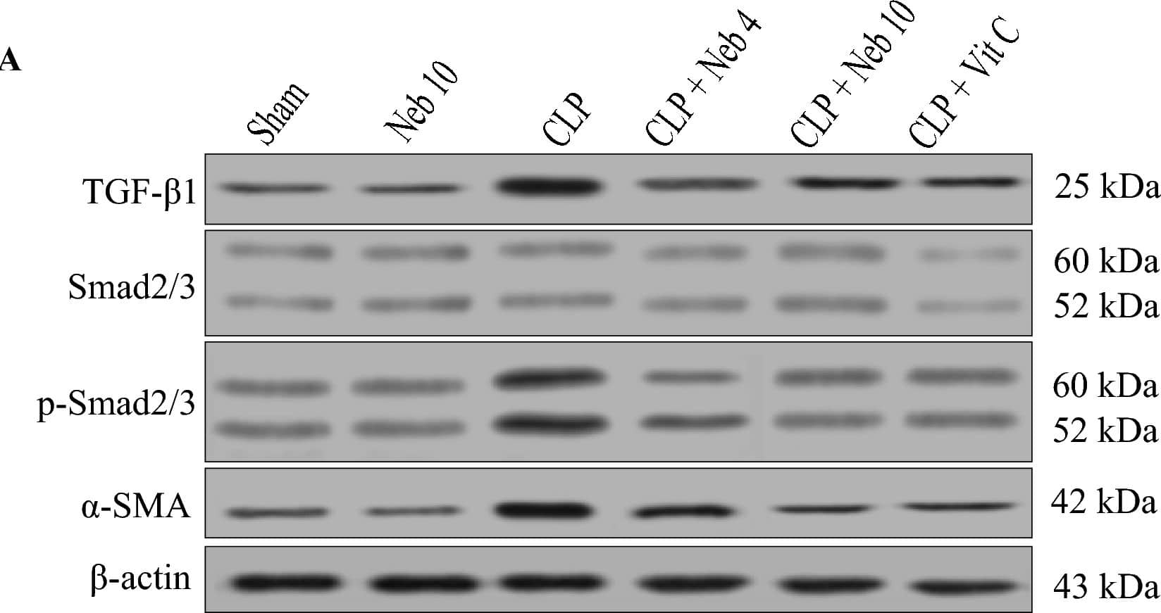 Effect of Nebivolol on TGF-beta 1, p-Smad2/3, and  alpha -SMA proteins expression. (A) representative western blot membranes of TGF-beta 1, Smad2/3, p-Smad2/3,  alpha -SMA, and  beta -actin proteins for all studied groups. (B–D) Expressions of TGF-beta 1, p-Smad2/3/t-Smad2/3, and  alpha -SMA proteins were represented densitometrically using bands in (A). Bars are represented as mean +/- SEM. The Tukey-Kramar test was used to analyze the significant differences between groups after conducting a one-way ANOVA test, where ###p < 0.001, compared to the sham group, *p < 0.05,**p < 0.01, and ***p < 0.001, compared to CLP group, $$p < 0.01, and $$$p < 0.001, compared to CLP + Neb4 group. Image collected and cropped by CiteAb from the following open publication (//www.nature.com/articles/s41598-024-64577-5), licensed under a CC-BY license. Not internally tested by Novus Biologicals.