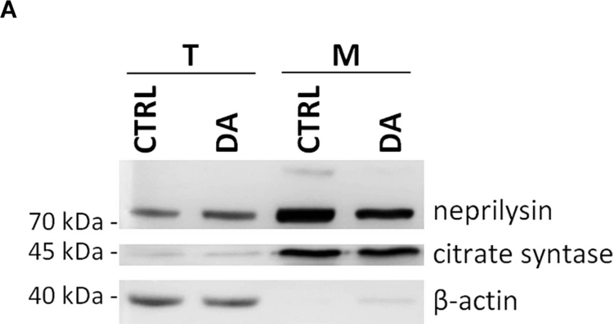 Neprilysin expression and localization in SH-SY5Y cells. (A) Representative WB analysis showing the presence of neprilysin in SH-SY5Y cells (T: total extracts) and its enrichment in mitochondrial isolates (M). (B) Relative fold-change in the levels of neprilysin in both total (T) and mitochondrial (M) extracts upon DA treatment, showing the significant enrichment of neprilysin in the mitochondrial fraction. Normalization was based on total protein amount per lane. Three biological replicates (n=3). Error bars: SEM. Statistical analysis performed by two-way ANOVA, to assess the effects of both “localization
