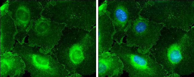 CD146 antibody [C1C3] detects CD146 protein at cell membrane and cytoplasm by immunofluorescent analysis.Sample: HUVEC cells were fixed in 4% paraformaldehyde at RT for 15 min.Green: CD146 protein stained by CD146 antibody [C1C3] (NBP2-15778) diluted at 1:500.Blue: Hoechst 33342 staining. 