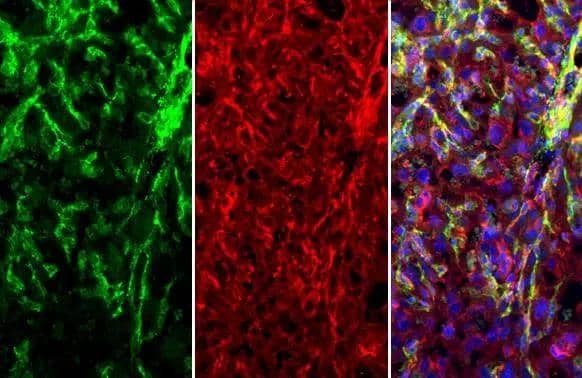 CD146 antibody [C1C3] detects CD146 protein at cell membrane by immunohistochemical analysis.Sample: Paraffin-embedded mouse placenta.Green: CD146 stained by CD146 antibody [C1C3] (NBP2-15778) diluted at 1:250.Red: alpha Tubulin, a cytoskeleton marker, stained by alpha Tubulin antibody [GT114]  diluted at 1:1000.Blue: Fluoroshield with DAPI .Antigen Retrieval: Citrate buffer, pH 6.0, 15 min 