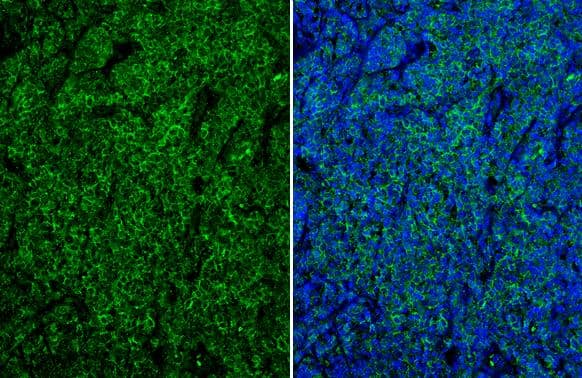 CD19 antibody [C1C3] detects CD19 protein at cell membrane and cytoplasm by immunohistochemical analysis.Sample: Paraffin-embedded human tonsil.Green: CD19 stained by CD19 antibody [C1C3] (NBP2-15782) diluted at 1:250.Blue: Fluoroshield with DAPI .Antigen Retrieval: Citrate buffer, pH 6.0, 15 min 