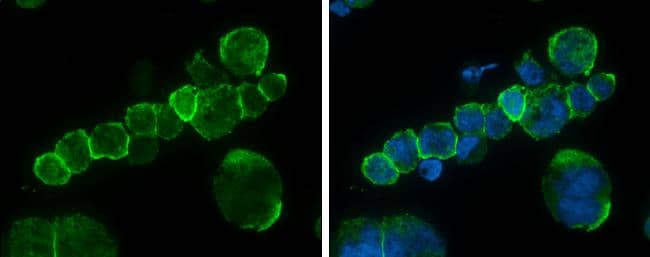 CD45 antibody detects CD45 protein at cell membrane by immunofluorescent analysis.Sample: THP-1 cells were fixed in 4% paraformaldehyde at RT for 15 min.Green: CD45 protein stained by CD45 antibody (NBP2-15811) diluted at 1:500.Blue: Hoechst 33342 staining. 