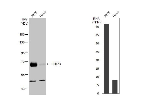 <b>Orthogonal Strategies Validation. </b>Western Blot: 5'-Nucleotidase/CD73 Antibody [NBP2-15815] - Various whole cell extracts (30 ug) were separated by 7.5% SDS-PAGE, and the membrane was blotted with CD73 antibody [N1N3]  diluted at 1:1000. The HRP-conjated anti-rabbit IgG antibody  was used to detect the primary antibody. Corresponding RNA expression data for the same cell lines are based on Human Protein Atlas program.