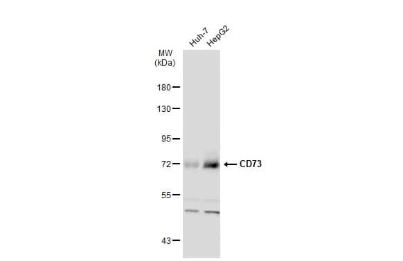 Western Blot: 5'-Nucleotidase/CD73 Antibody [NBP2-15815] - Various whole cell extracts (30 ug) were separated by 7.5% SDS-PAGE, and the membrane was blotted with 5'-Nucleotidase/CD73 antibody [N1N3] (NBP2-15815) diluted at 1:1000. The HRP-conjugated anti-rabbit IgG antibody  was used to detect the primary antibody.