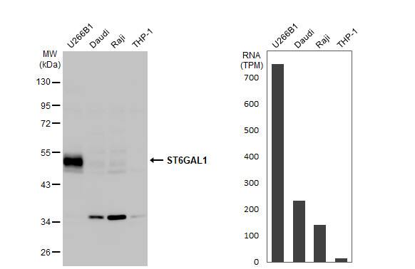 <b>Orthogonal Strategies Validation. </b>Western Blot: ST6 Gal Sialyltransferase 1/ST6GAL1/CD75 Antibody [NBP2-15817] - Various whole cell extracts (30 ug) were separated by 10% SDS-PAGE, and the membrane was blotted with CD75 antibody [N2C3]  diluted at 1:500. The HRP-conjugated anti-rabbit IgG antibody  was used to detect the primary antibody. Corresponding RNA expression data for the same cell lines are based on Human Protein Atlas program.