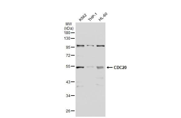 Various whole cell extracts (30 ug) were separated by 10% SDS-PAGE, and the membrane was blotted with CDC20 antibody (NBP2-15825) diluted at 1:1000. The HRP-conjugated anti-rabbit IgG antibody  was used to detect the primary antibody. 