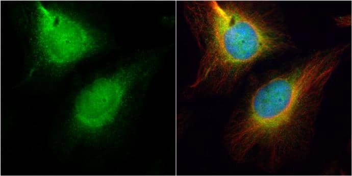CDC45L antibody [N3C3] detects CDC45L protein at cytoplasm and nucleus by immunofluorescent analysis.Sample: HeLa cells were fixed in 4% paraformaldehyde at RT for 15 min.Green: CDC45L protein stained by CDC45L antibody [N3C3] (NBP2-15834) diluted at 1:500.Red: alpha Tubulin, a cytoskeleton marker, stained by alpha Tubulin antibody [B-5-1-2]  diluted at 1:10000.Blue: Hoechst 33342 staining. 