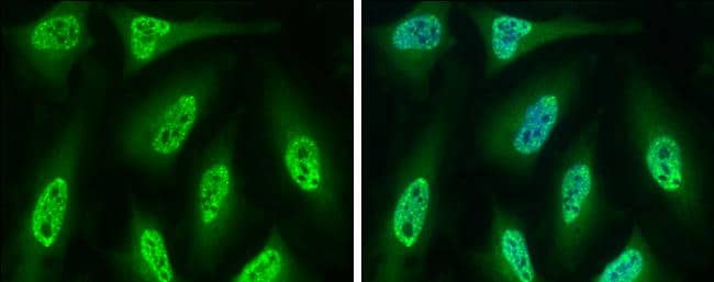 CDC6 antibody detects CDC6 protein at nucleus by immunofluorescent analysis.Sample: HeLa cells were fixed in 4% paraformaldehyde at RT for 15 min.Green: CDC6 protein stained by CDC6 antibody (NBP2-15837) diluted at 1:500.Blue: Hoechst 33342 staining. 